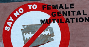FGM